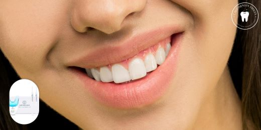 ¿Cuál es el mejor método para blanquear los dientes sin riesgo para el esmalte?