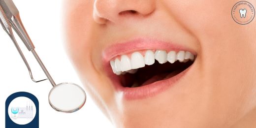 ¿Cuáles son los pasos a seguir para utilizar correctamente un kit de blanqueamiento dental?