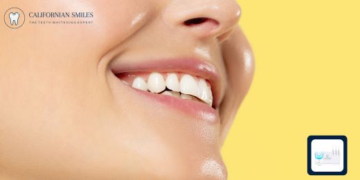 ¿Cuáles son los factores que pueden afectar la eficacia de un kit de blanqueamiento dental?