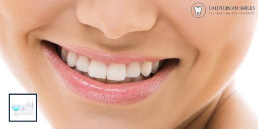¿Cuáles son los errores comunes que se deben evitar al utilizar un kit de blanqueamiento dental?