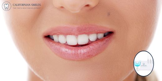 ¿Cómo almacenar adecuadamente tu kit de blanqueamiento dental para asegurar su durabilidad?